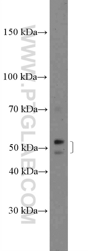 Western Blot (WB) analysis of A549 cells using ZDHHC1 Polyclonal antibody (26545-1-AP)