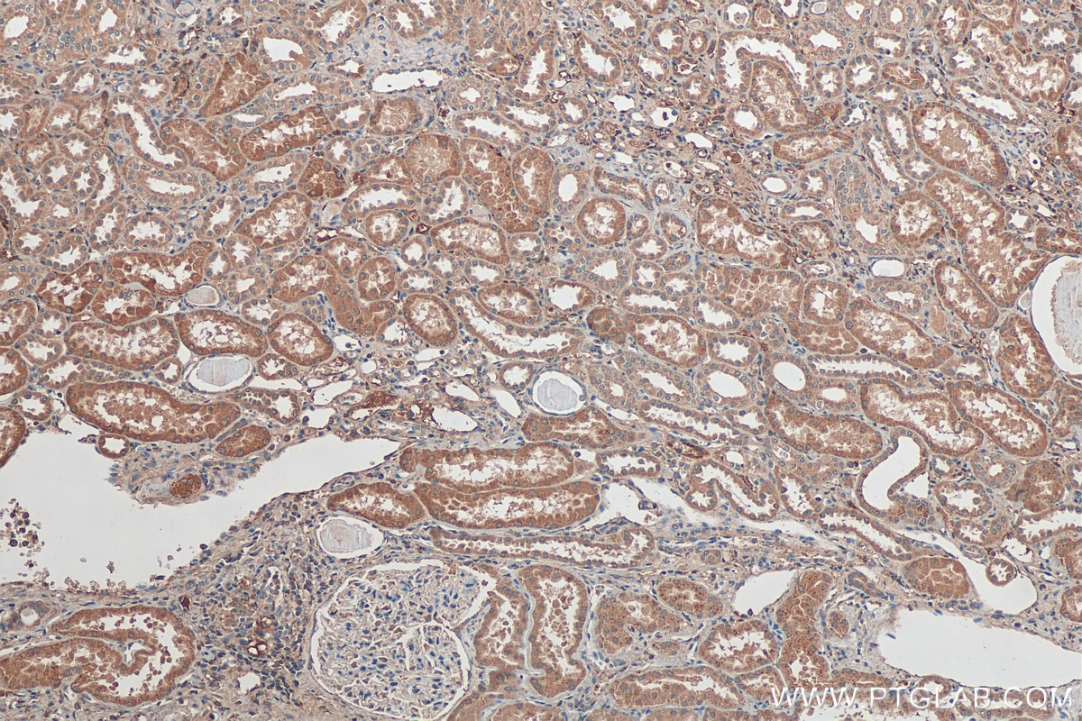 Immunohistochemistry (IHC) staining of human kidney tissue using ZDHHC12 Polyclonal antibody (26433-1-AP)