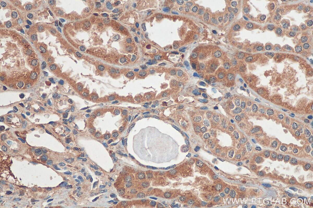 Immunohistochemistry (IHC) staining of human kidney tissue using ZDHHC12 Polyclonal antibody (26433-1-AP)