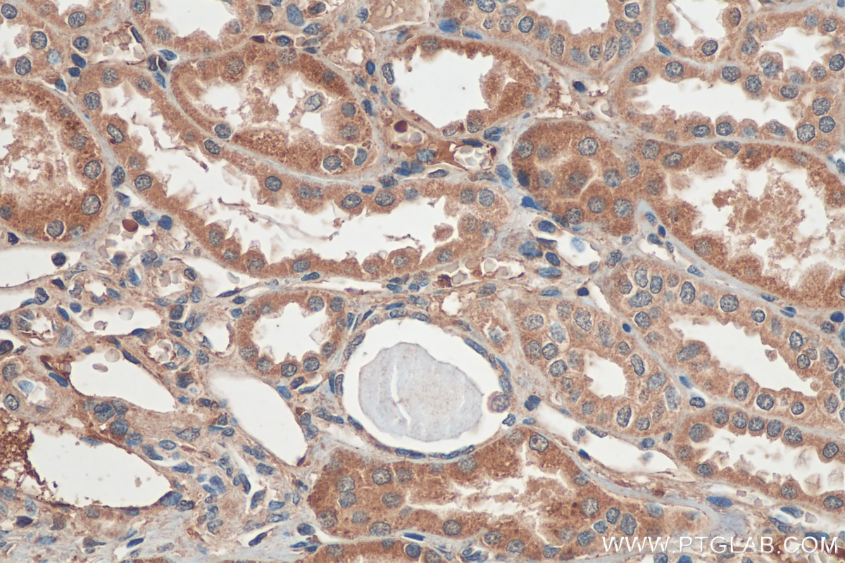 IHC staining of human kidney using 26433-1-AP