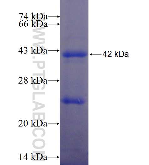 ZDHHC12 fusion protein Ag23634 SDS-PAGE