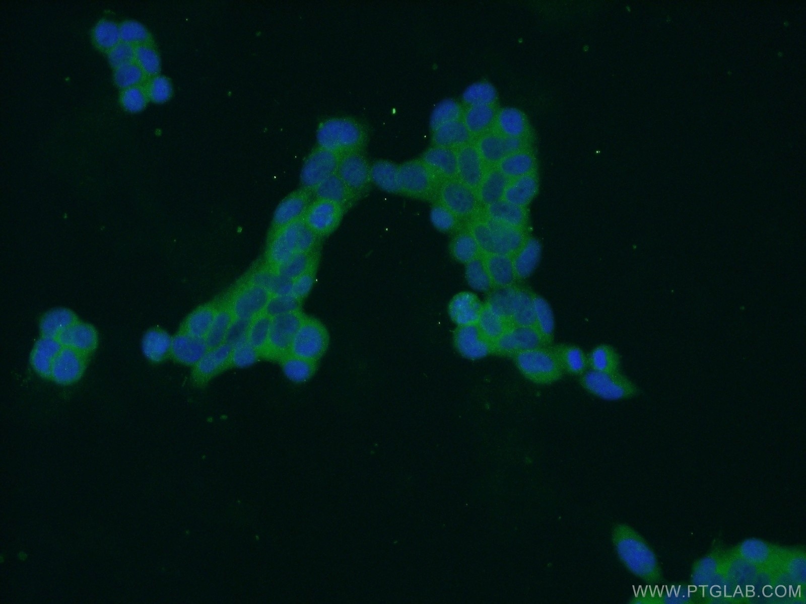 Immunofluorescence (IF) / fluorescent staining of HEK-293 cells using ZDHHC13 Polyclonal antibody (24759-1-AP)
