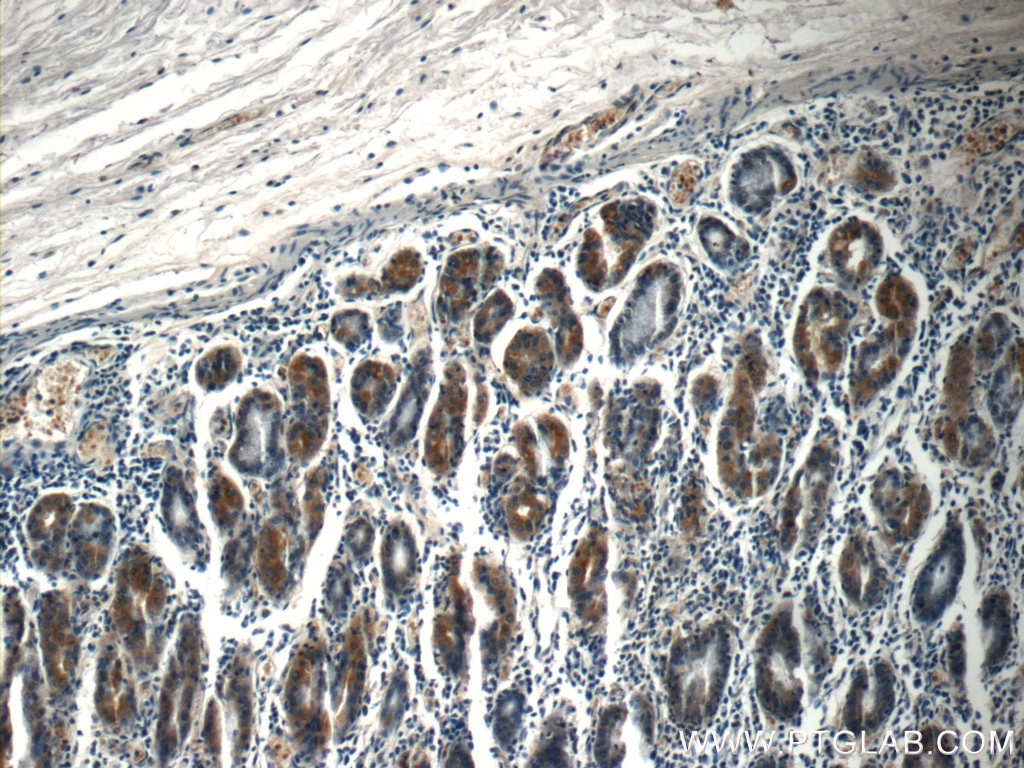 Immunohistochemistry (IHC) staining of human stomach tissue using ZDHHC13 Polyclonal antibody (24759-1-AP)
