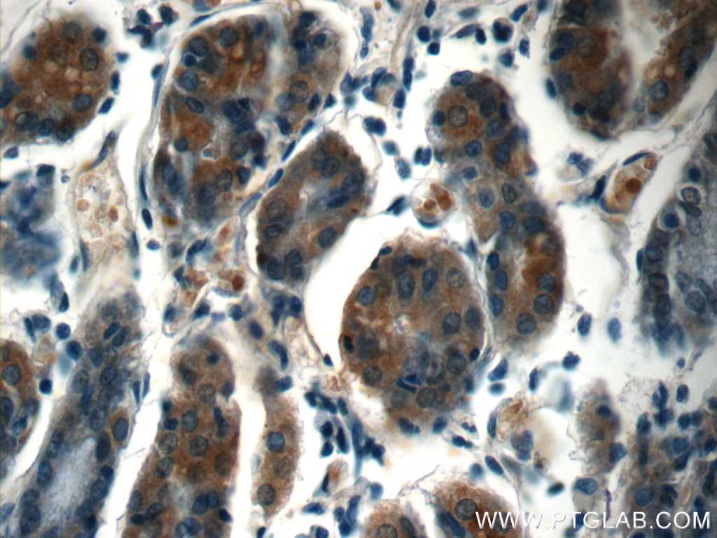 Immunohistochemistry (IHC) staining of human stomach tissue using ZDHHC13 Polyclonal antibody (24759-1-AP)