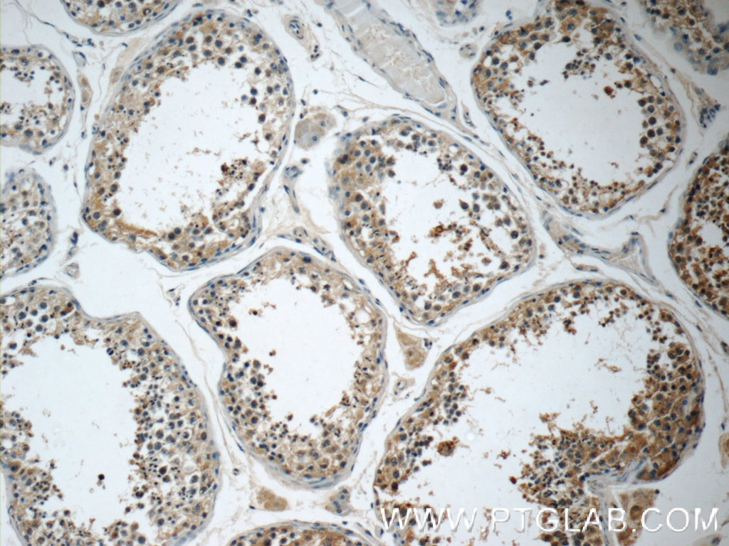 Immunohistochemistry (IHC) staining of human testis tissue using ZDHHC13 Polyclonal antibody (24759-1-AP)