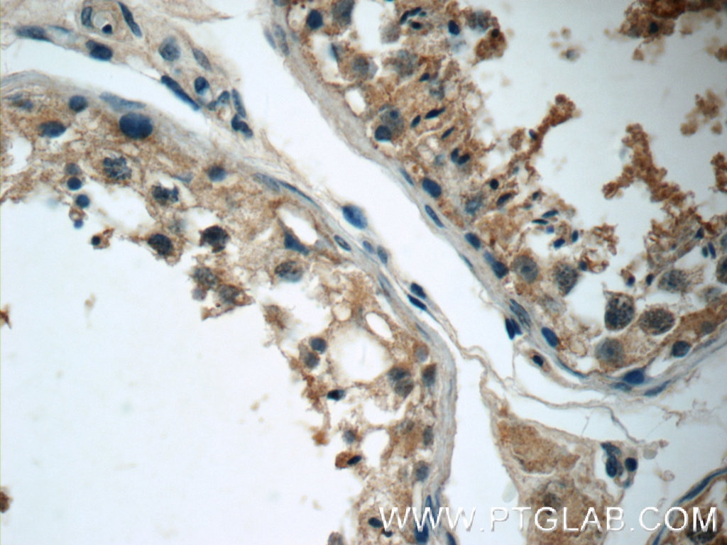 Immunohistochemistry (IHC) staining of human testis tissue using ZDHHC13 Polyclonal antibody (24759-1-AP)