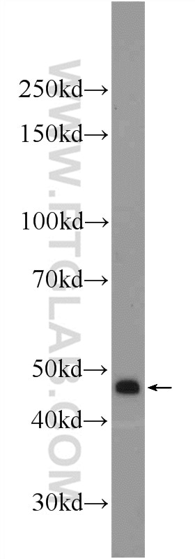 Western Blot (WB) analysis of mouse testis tissue using ZDHHC13 Polyclonal antibody (24759-1-AP)