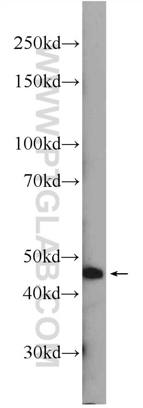 Western Blot (WB) analysis of mouse skin tissue using ZDHHC13 Polyclonal antibody (24759-1-AP)