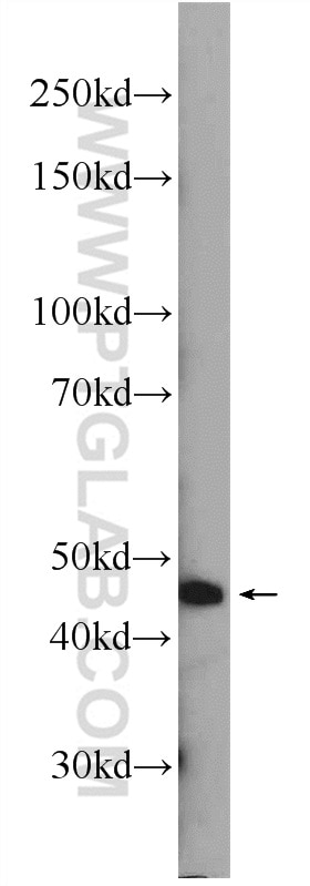 Western Blot (WB) analysis of mouse skin tissue using ZDHHC13 Polyclonal antibody (24759-1-AP)