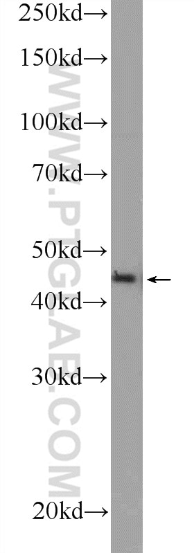 Western Blot (WB) analysis of HEK-293 cells using ZDHHC13 Polyclonal antibody (24759-1-AP)