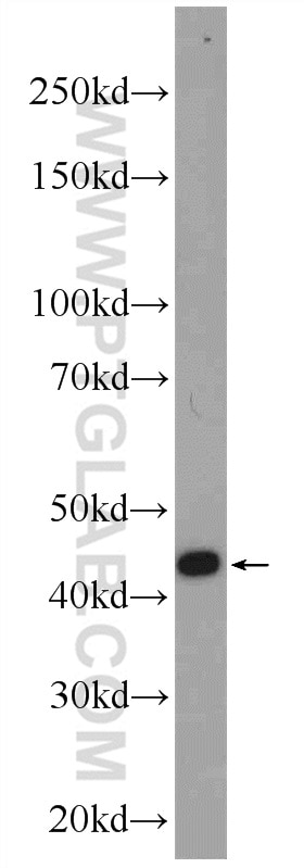 Western Blot (WB) analysis of Neuro-2a cells using ZDHHC13 Polyclonal antibody (24759-1-AP)