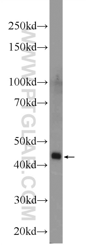 Western Blot (WB) analysis of mouse kidney tissue using ZDHHC13 Polyclonal antibody (24759-1-AP)