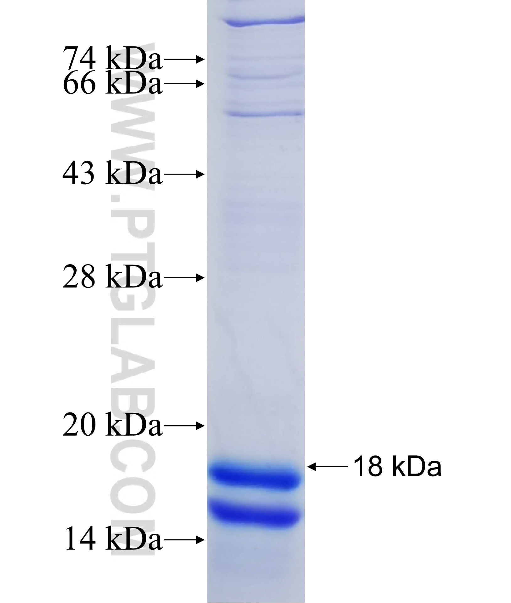 ZDHHC13 fusion protein Ag33991 SDS-PAGE ZDHHC13 fusion protein Ag33991 SDS-PAGE