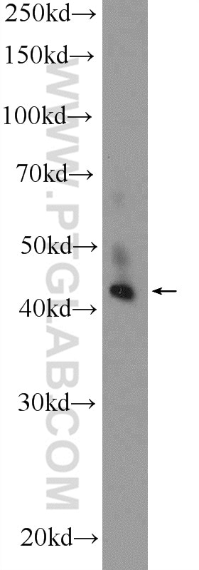Western Blot (WB) analysis of SMMC-7721 cells using ZDHHC15 Polyclonal antibody (21627-1-AP)