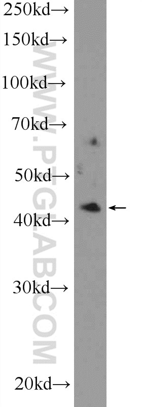 Western Blot (WB) analysis of SMMC-7721 cells using ZDHHC15 Polyclonal antibody (21627-1-AP)