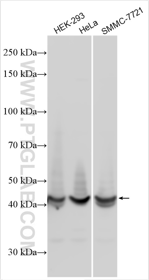 Western Blot (WB) analysis of various lysates using ZDHHC15 Polyclonal antibody (21627-1-AP)