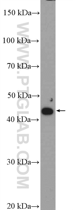 Western Blot (WB) analysis of SMMC-7721 cells using ZDHHC15 Polyclonal antibody (21627-1-AP)