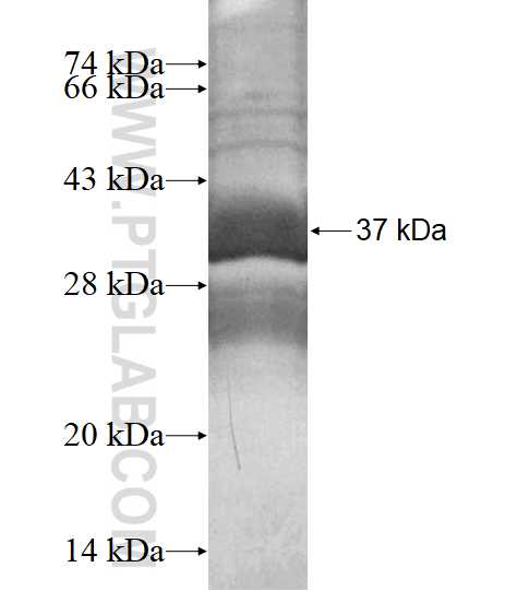 ZDHHC15 fusion protein Ag16152 SDS-PAGE