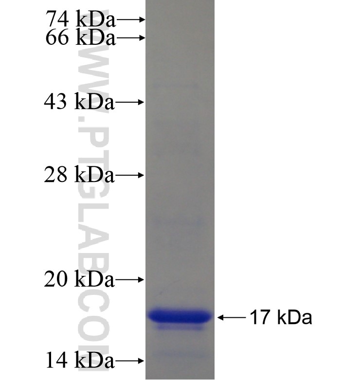 ZDHHC15 fusion protein Ag16740 SDS-PAGE
