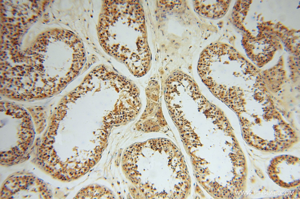 Immunohistochemistry (IHC) staining of human testis tissue using HIP14; ZDHHC17 Polyclonal antibody (15465-1-AP)