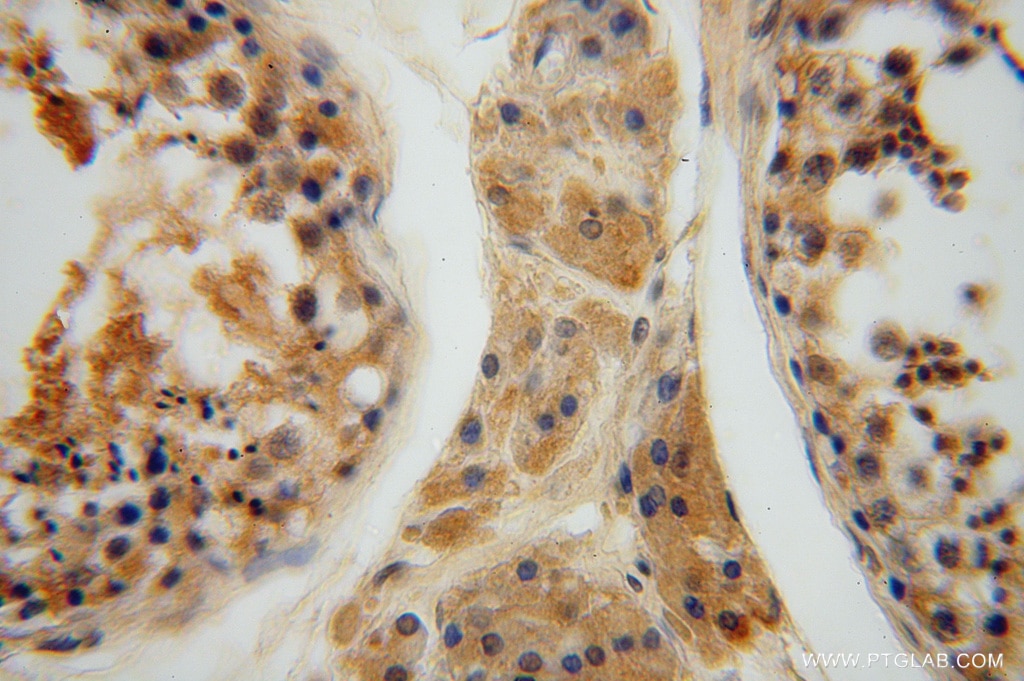 IHC staining of human testis using 15465-1-AP