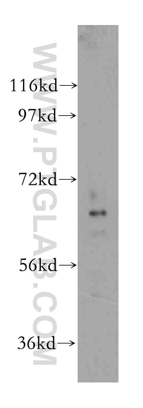 Western Blot (WB) analysis of human kidney tissue using HIP14; ZDHHC17 Polyclonal antibody (15465-1-AP)