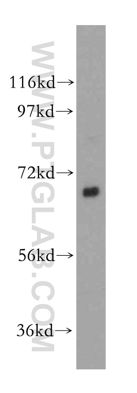 Western Blot (WB) analysis of Raji cells using HIP14; ZDHHC17 Polyclonal antibody (15465-1-AP)