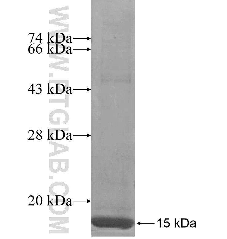 ZDHHC19 fusion protein Ag16910 SDS-PAGE