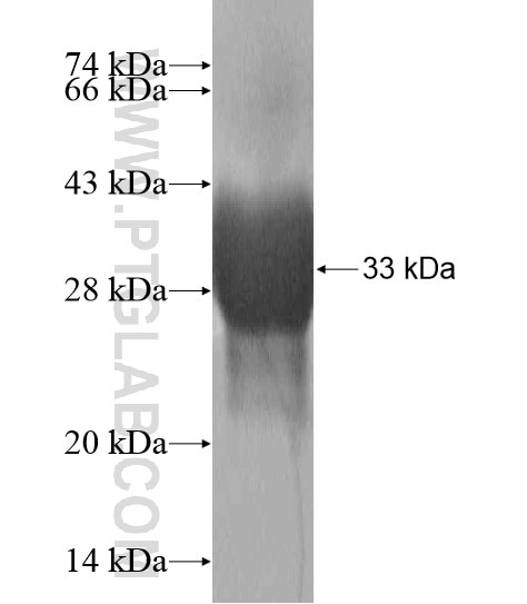 ZDHHC2 fusion protein Ag20158 SDS-PAGE