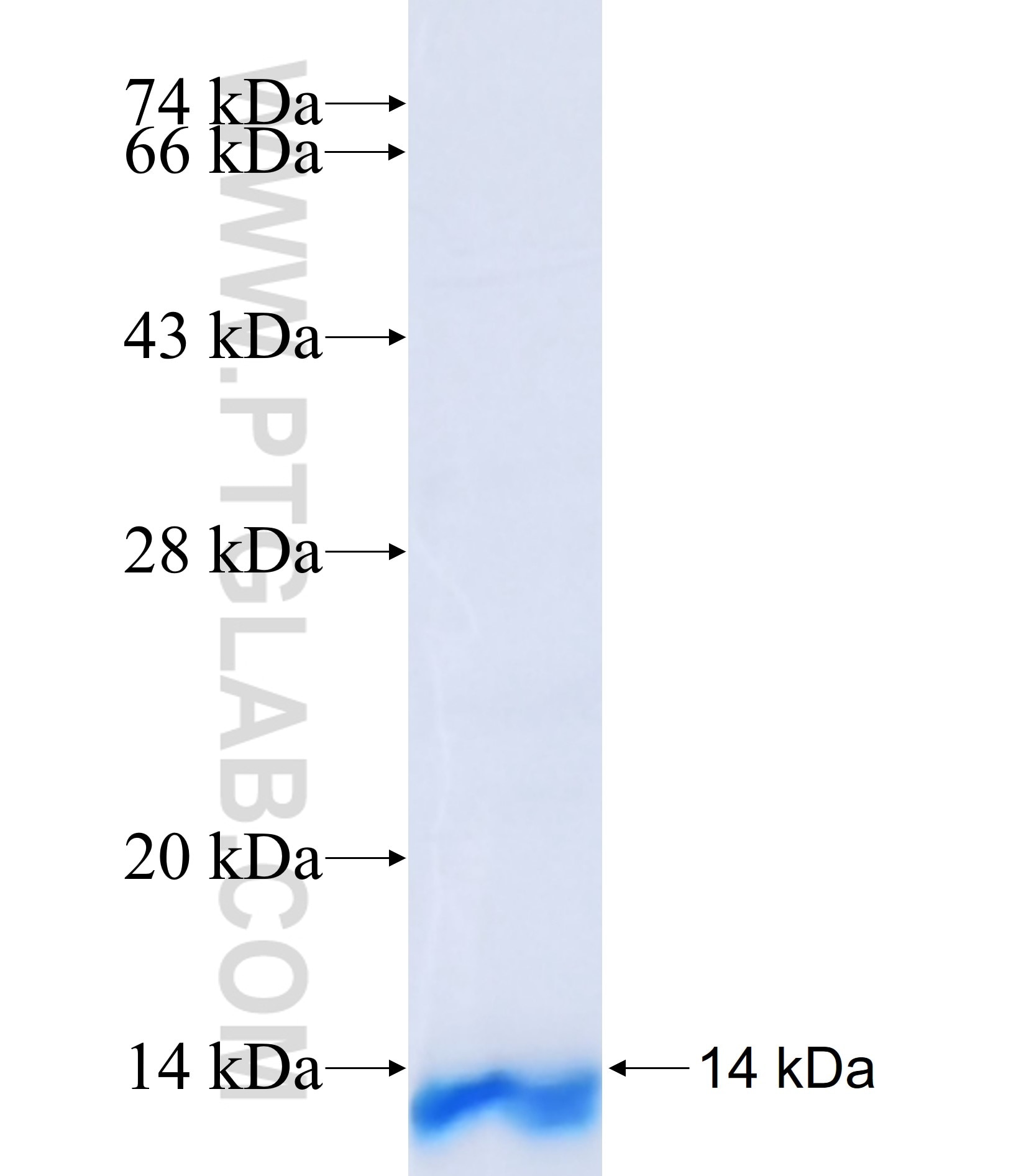 ZDHHC3 fusion protein Ag39872 SDS-PAGE ZDHHC3 fusion protein Ag39872 SDS-PAGE