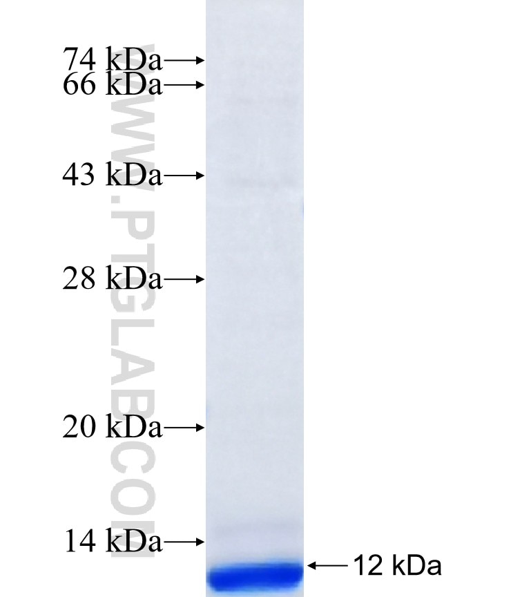 ZDHHC4 fusion protein Ag39979 SDS-PAGE ZDHHC4 fusion protein Ag39979 SDS-PAGE
