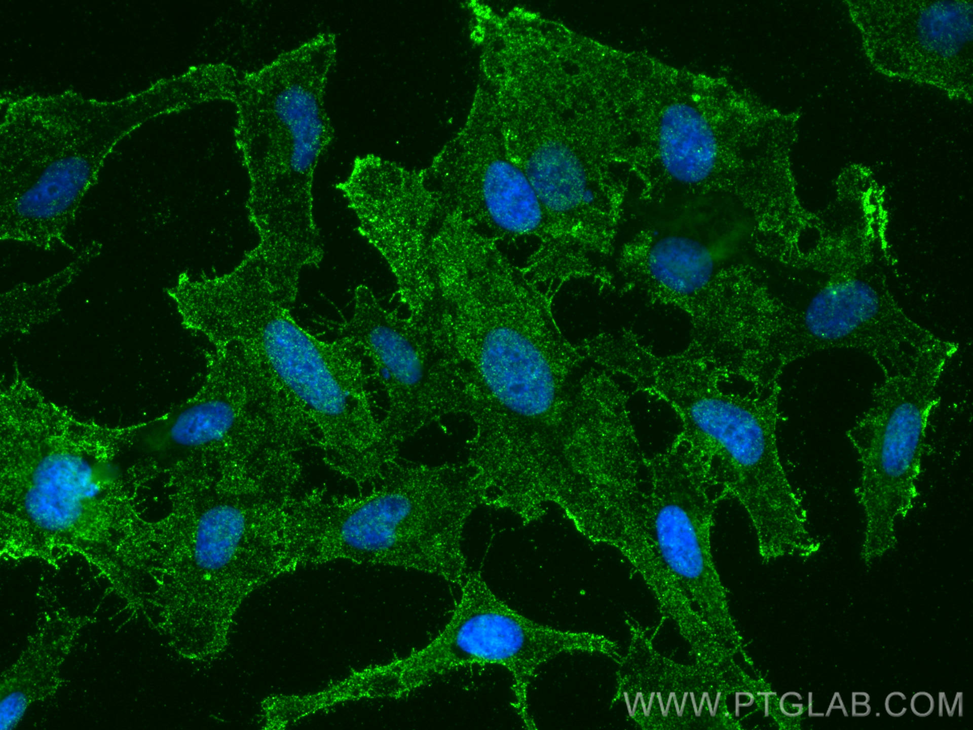 Immunofluorescence (IF) / fluorescent staining of HeLa cells using ZDHHC5 Polyclonal antibody (21324-1-AP)