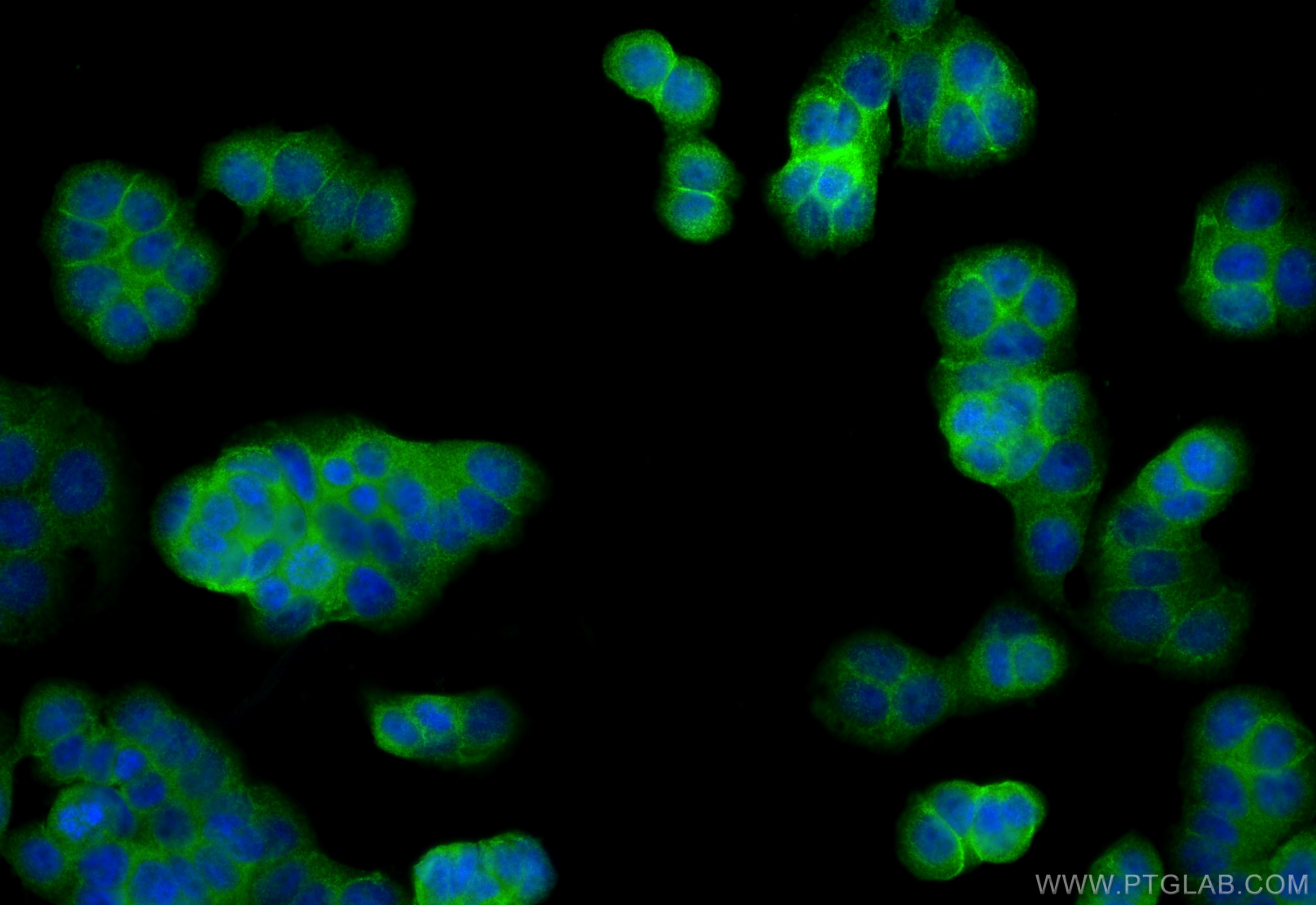 Immunofluorescence (IF) / fluorescent staining of HT-29 cells using ZDHHC5 Polyclonal antibody (21324-1-AP)