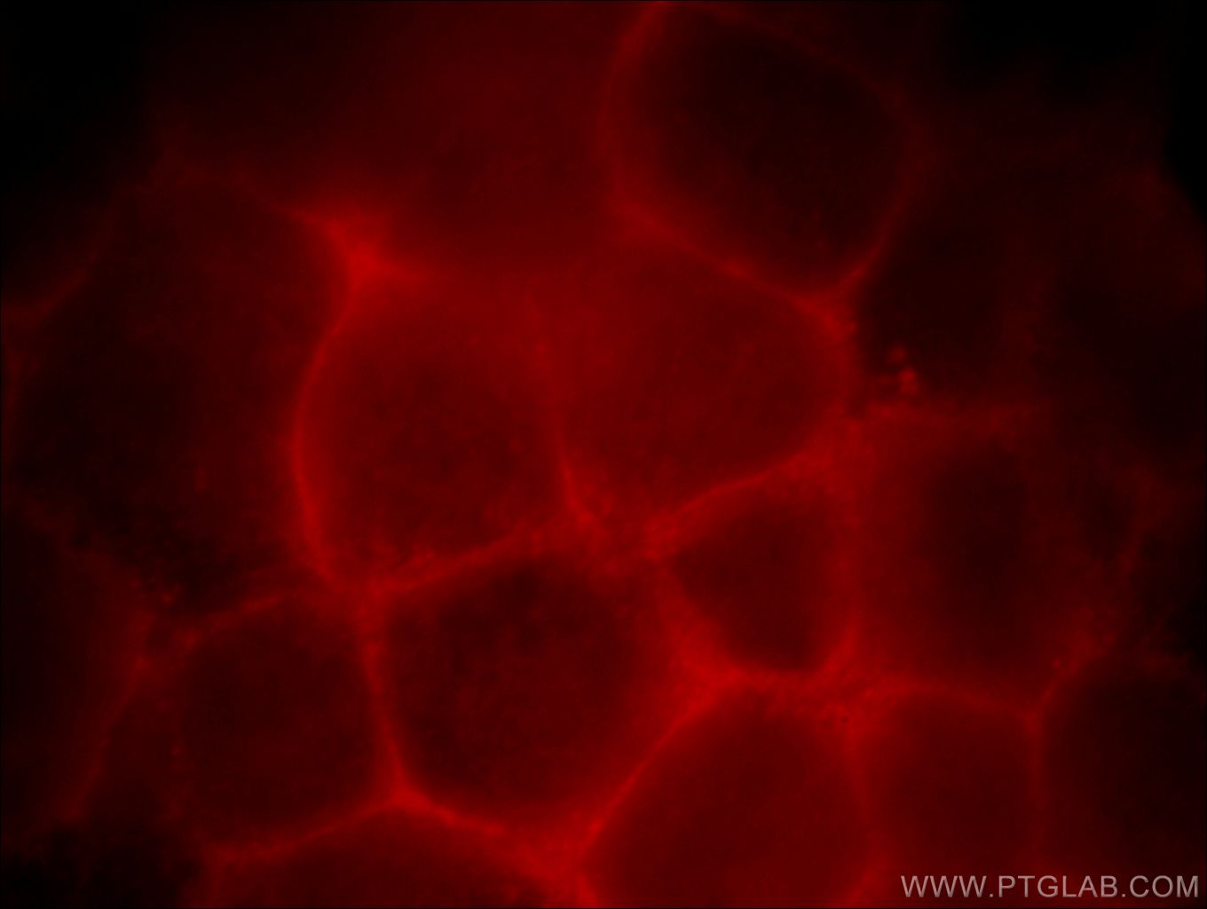 Immunofluorescence (IF) / fluorescent staining of HeLa cells using ZDHHC5 Polyclonal antibody (21324-1-AP)