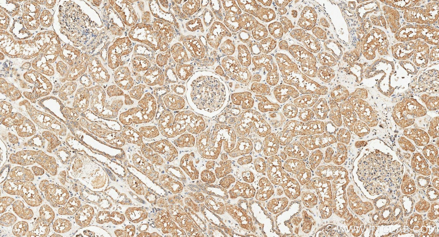Immunohistochemistry (IHC) staining of human kidney tissue using ZDHHC5 Polyclonal antibody (21324-1-AP)
