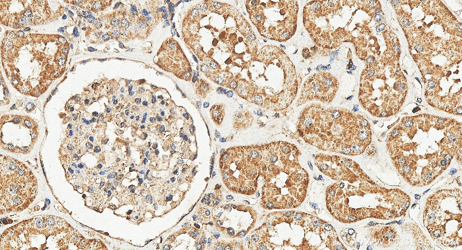 Immunohistochemistry (IHC) staining of human kidney tissue using ZDHHC5 Polyclonal antibody (21324-1-AP)