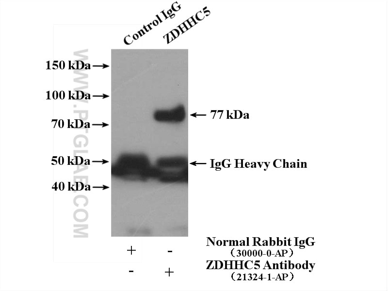 Immunoprecipitation (IP) experiment of HEK-293 cells using ZDHHC5 Polyclonal antibody (21324-1-AP)