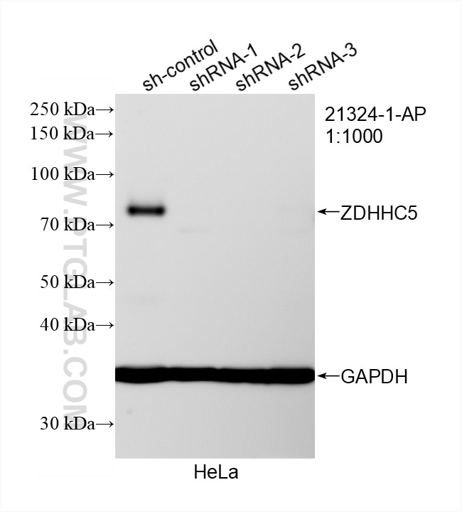Western Blot (WB) analysis of HeLa cells using ZDHHC5 Polyclonal antibody (21324-1-AP)