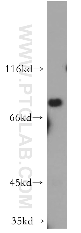 Western Blot (WB) analysis of mouse kidney tissue using ZDHHC5 Polyclonal antibody (21324-1-AP)