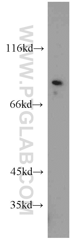 Western Blot (WB) analysis of mouse brain tissue using ZDHHC5 Polyclonal antibody (21324-1-AP)