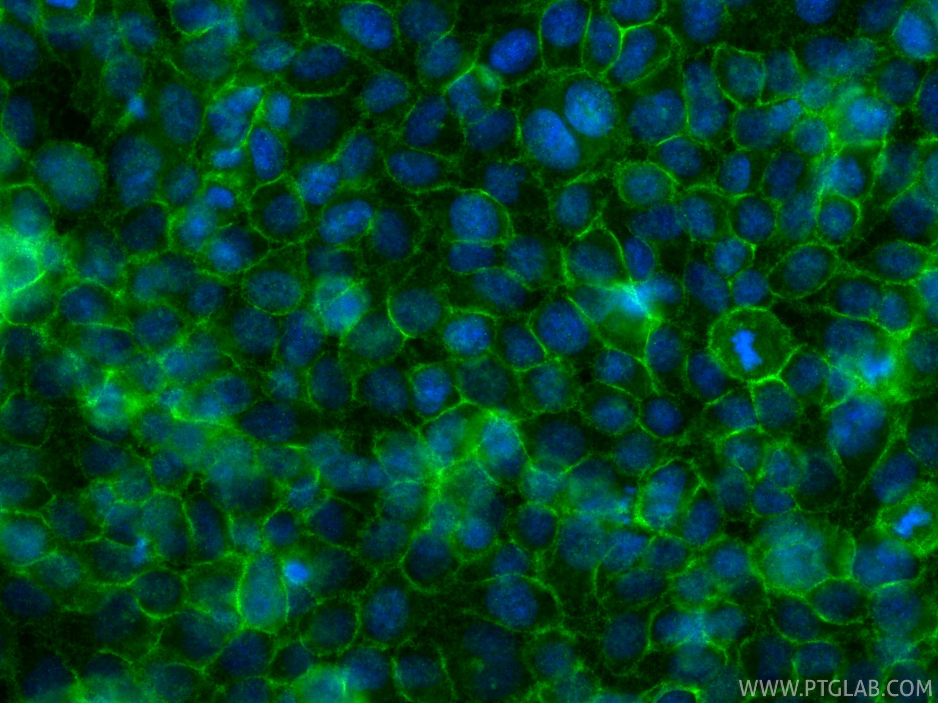 IF Staining of HeLa using 84803-4-RR Immunofluorescence (IF) / fluorescent staining of HeLa cells using ZDHHC5 Recombinant monoclonal antibody (84803-4-RR)