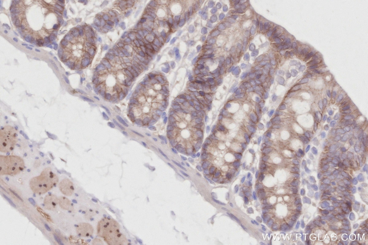 IHC staining of rat colon using 84803-4-RR Immunohistochemistry (IHC) staining of rat colon tissue using ZDHHC5 Recombinant monoclonal antibody (84803-4-RR)