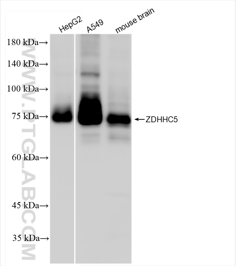 Western Blot (WB) analysis of various lysates using ZDHHC5 Recombinant antibody (84803-4-RR)