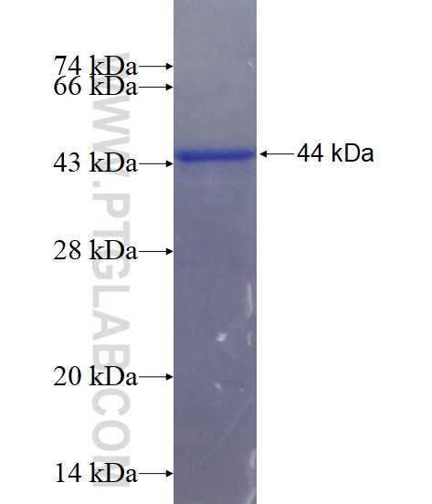 ZDHHC5 fusion protein Ag14891 SDS-PAGE