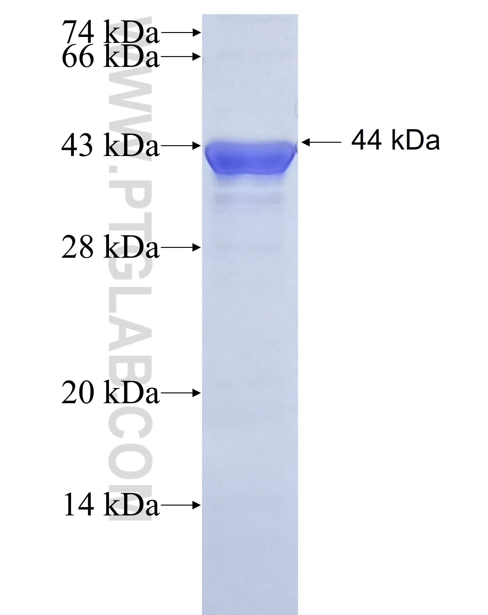 ZDHHC5 fusion protein Ag14891 SDS-PAGE