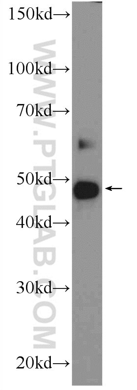 Western Blot (WB) analysis of PC-3 cells using ZDHHC7 Polyclonal antibody (25985-1-AP)