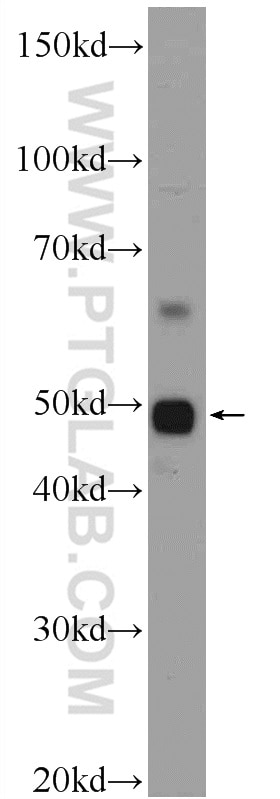 Western Blot (WB) analysis of MCF-7 cells using ZDHHC7 Polyclonal antibody (25985-1-AP)