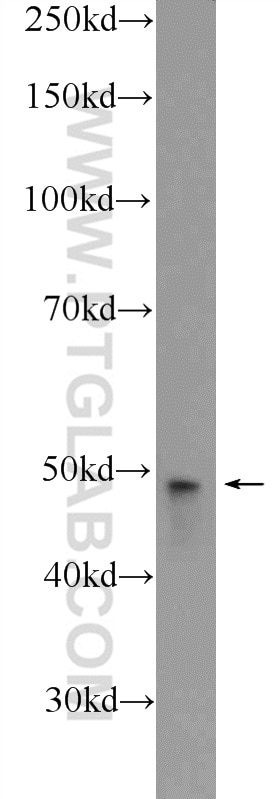 Western Blot (WB) analysis of MCF-7 cells using ZDHHC7 Polyclonal antibody (25985-1-AP)