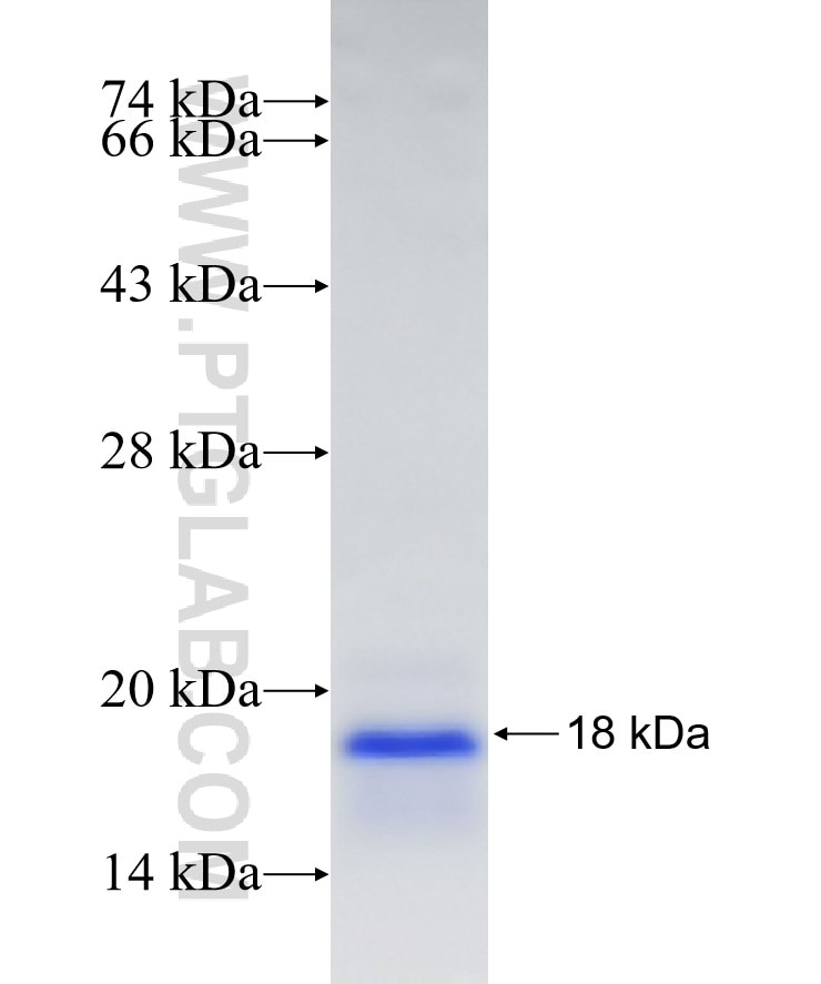ZDHHC7 fusion protein Ag23185 SDS-PAGE