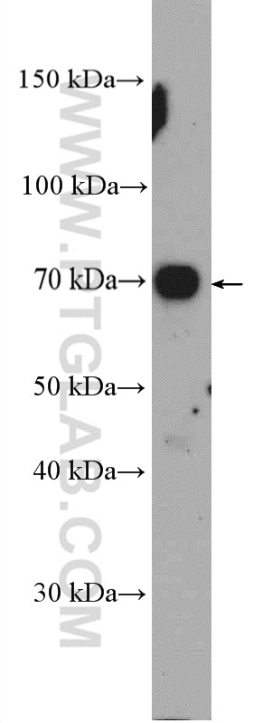 Western Blot (WB) analysis of K-562 cells using ZDHHC8 Polyclonal antibody (27179-1-AP)